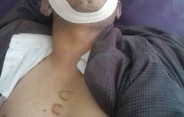 مقتل مواطن على يد نقطة حوثية بالعاصمةصنعاء.