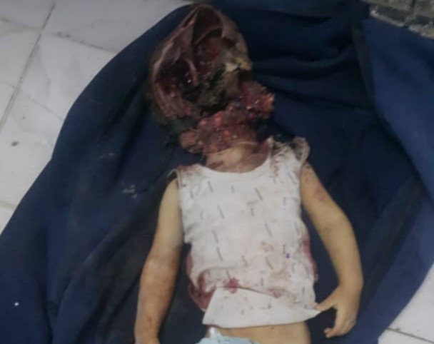 مقتل طفل وإصابة ثلاثة آخرين في قصف مدفعي لمليشيات الحوثي على حي سكني بتعز