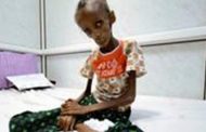 منظمة اللاجئين الأممية تحذر من سوء التغذية في اليمن