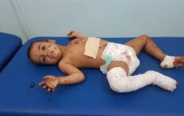إصابة طفلين بانفجار لغم من مخلفات الحوثيين بالجوف