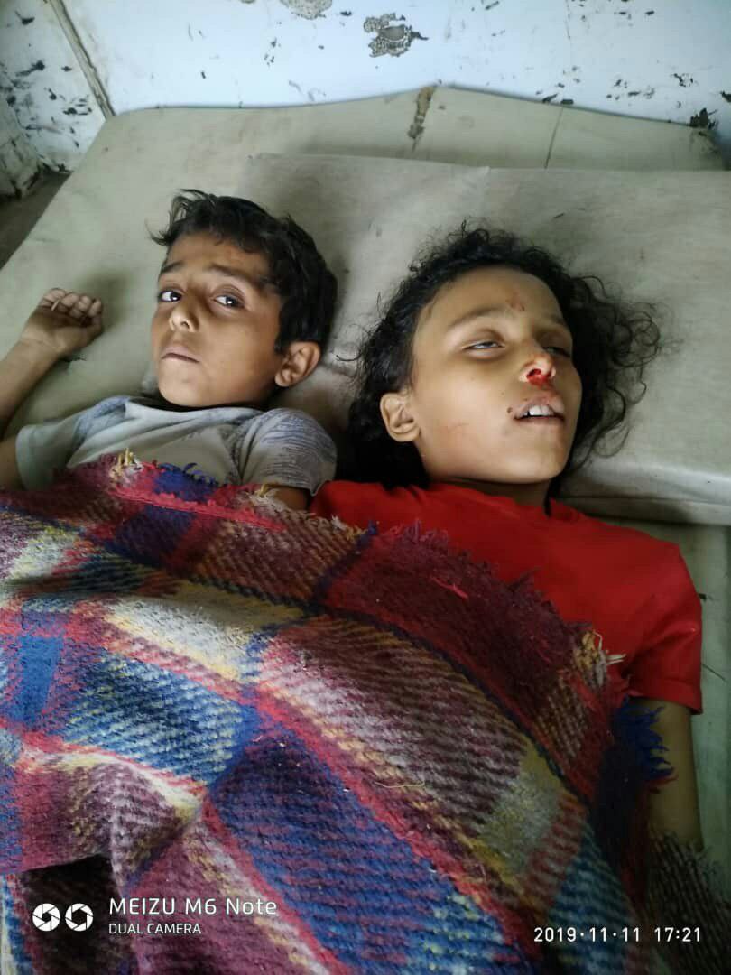 مقتل واصابة 4 أطفال بقصف حوثي بالصلو جنوب تعز