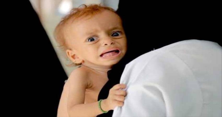 منظمة اممية : اليمن لا يزال ضمن أسوأ البلدان للأطفال في العالم