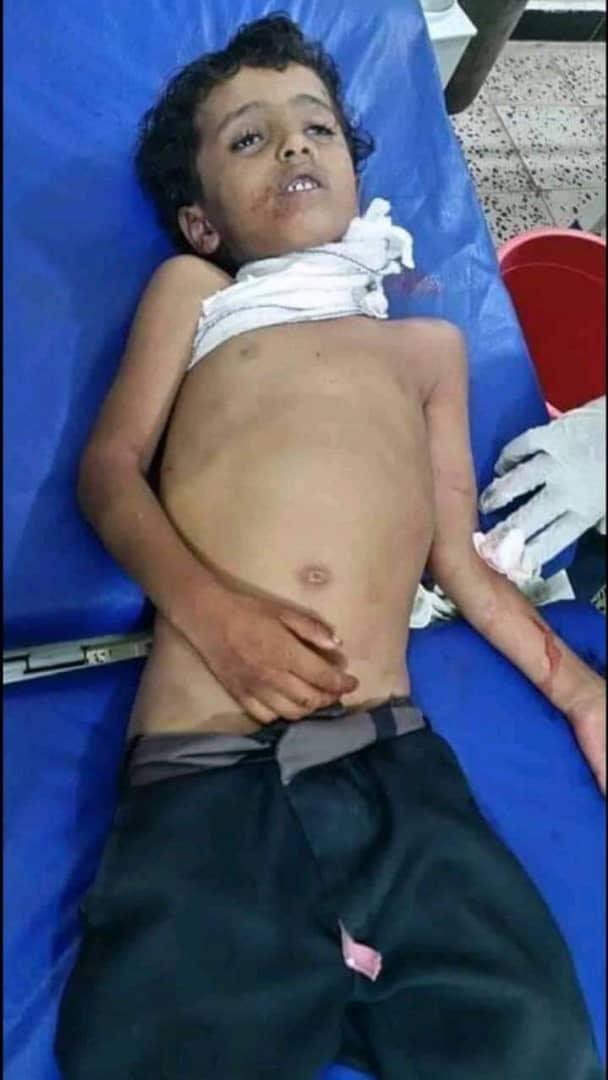 قذيفة حوثية تقتل طفل في قرية المشاريح بحجر