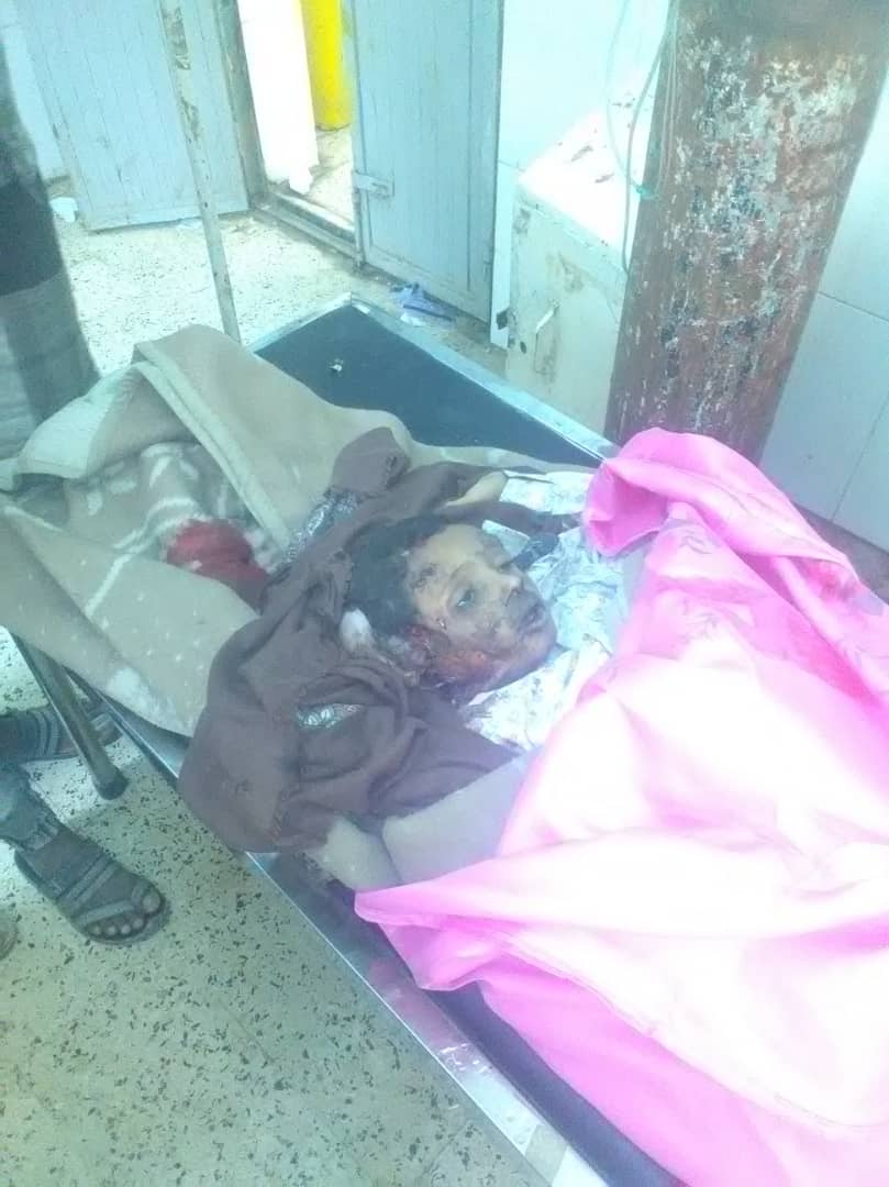 حادث مروري يودي بحياة طفل في محافظة لحج