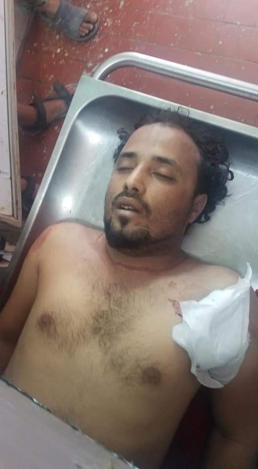مقتل سائق باص برصاص مسلح وسط مدينة تعز
