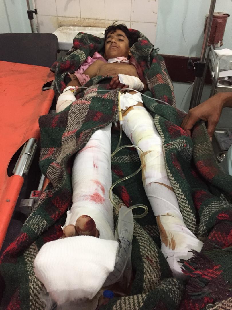 إصابة طفل بشظايا قذيفة أطلقها الحوثيون على منازل المواطنين في حجر