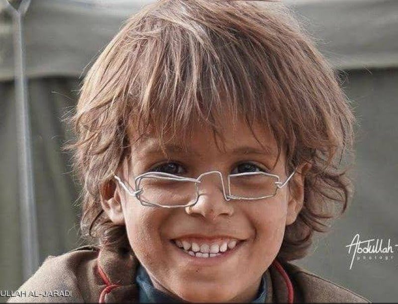 «نظارة» طفل يمني نازح تحصد 2.5 مليون ريال
