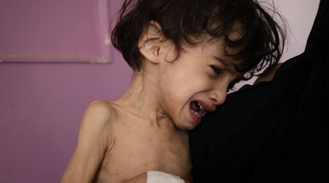 تقرير الأمم المتحدةعن ثلث محافظات اليمن على شفير المجاعة