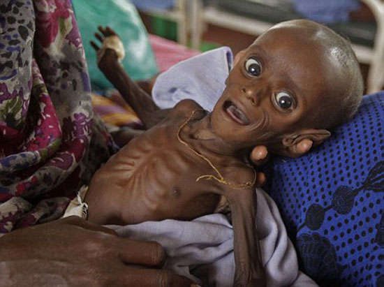 الجوع يهدد بموت في  بجنوب الصومال ويقتل 26 شخصا