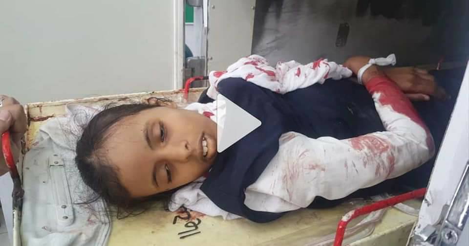 مقتل وجرح خمس طالبات بسقوط قذيفة حوثية بالقرب من مدرسة في تعز