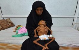 اليونيسف: إثنين مليون طفل يمني يعانون من سوء التغذية الحاد