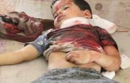 ألغام الحوثي قتلت وأصابت 728 طفلاً