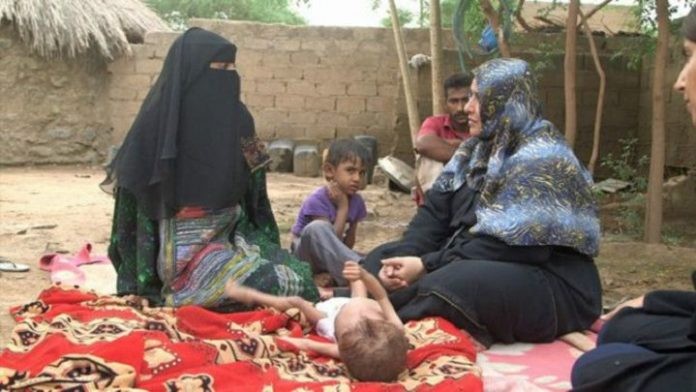 اليمن: سبع حالات وفاة كل ساعتين للحوامل وحديثي الولادة