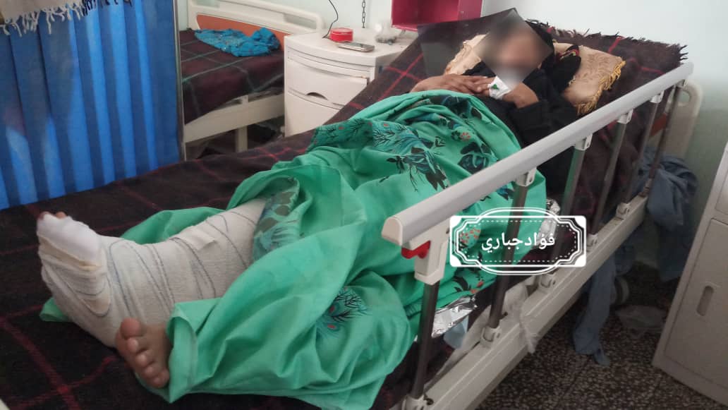 إصابة إمرأة حامل برصاصة قناص حوثي شمال غرب الضالع9