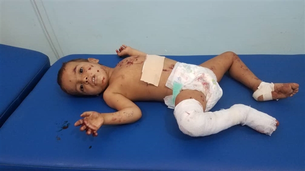 إصابة طفلين بانفجار لغم من مخلفات الحوثيين بالجوف