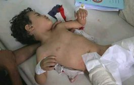 إصابة 5 أطفال بقذيفة حوثية شرق مدينة تعز