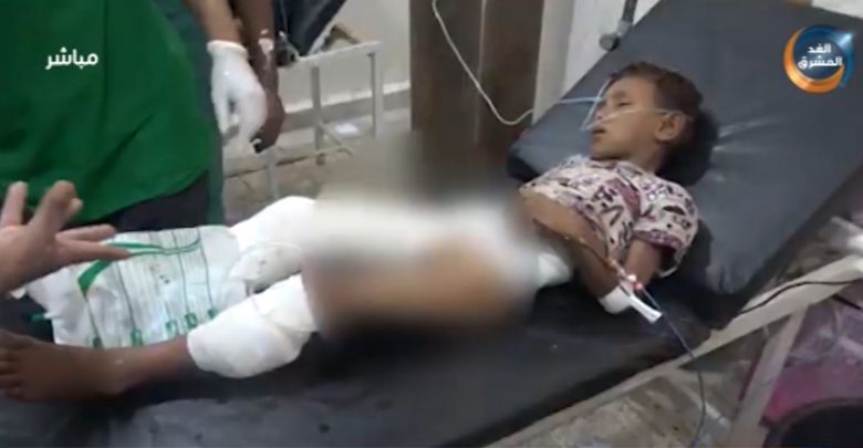 اصابة طفل بقصف عشوائي على الأحياء السكنية بالتحيتا