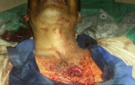 صنعاء : أحد عناصر مليشيات الحوثي يقتل والده