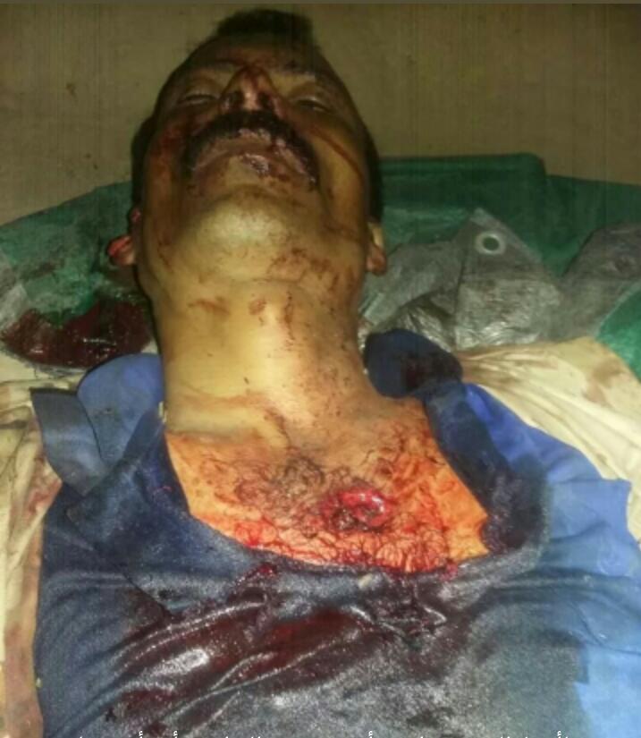 صنعاء : أحد عناصر مليشيات الحوثي يقتل والده