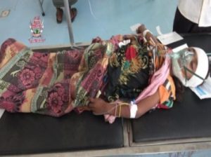 الحديدة : إصابة طفلة بنيران قناص حوثي