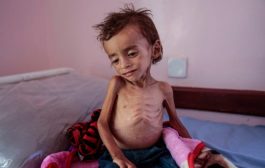 الصحة العالمية: إنعدام علاج السرطان يقتل 35 ألف يمني