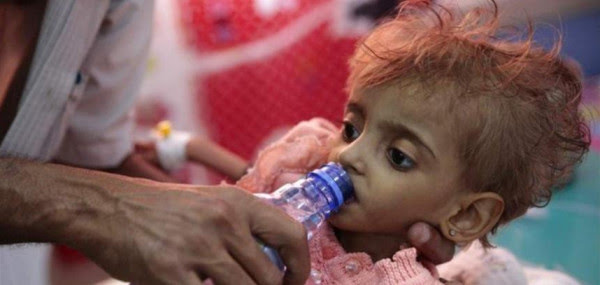 257 وفاة بالدفتيريا في اليمن خلال 26 شهراً