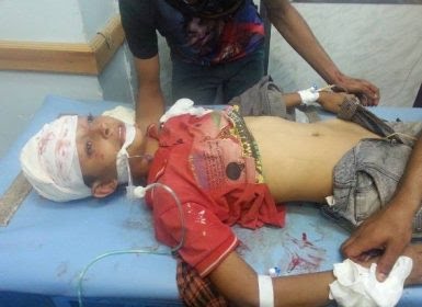 منظمة أنقذوا الطفولة: مقتل وإصابة 33 طفل شهرياً في الحديدة وتعز في 2019