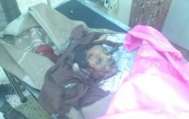 حادث مروري يودي بحياة طفل في محافظة لحج