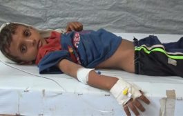 تقرير حقوقي.. 33 طفلا ضحايا شهريا في الحديدة وتعز