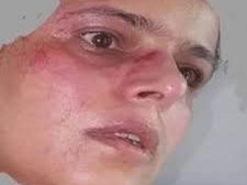 الناشطة ابتسام ابو دنيا تتعرض للاعتداء من قبل مليشيات الحوثي