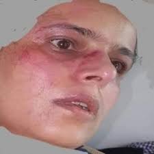 الناشطة ابتسام ابو دنيا تتعرض للاعتداء من قبل مليشيات الحوثي