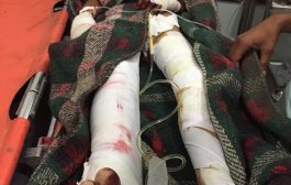 إصابة طفل بشظايا قذيفة أطلقها الحوثيون على منازل المواطنين في حجر