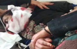قناص حوثي يستهدف امرأة خمسينية في ريف تعز