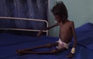 “الغذاء العالمي” يحدد سبعة عوامل قد تعرض اليمن للانزلاق إلى خطر المجاعة