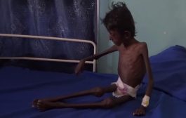 “الغذاء العالمي” يحدد سبعة عوامل قد تعرض اليمن للانزلاق إلى خطر المجاعة