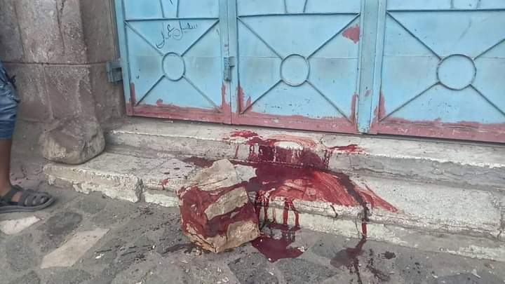مقتل واصابة اربعة مدنيين بقذيفة حوثية على حي سكني بتعز