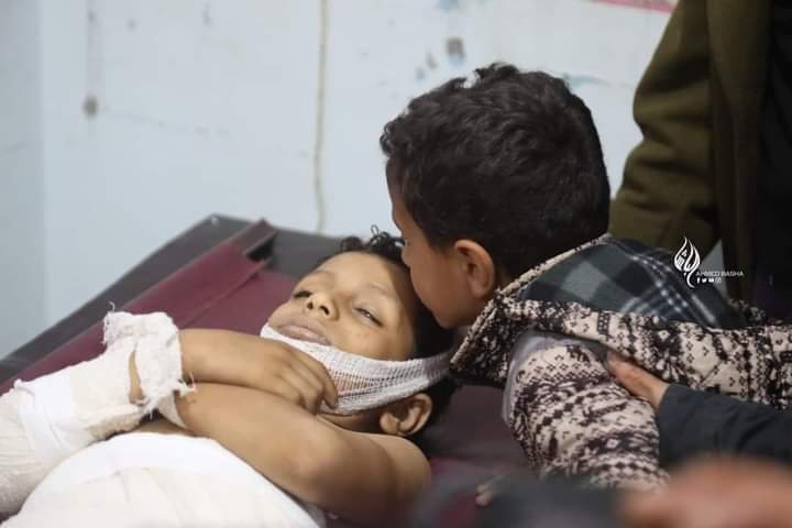 مقتل طفل وإصابة آخرين في قصف حوثي بتعز