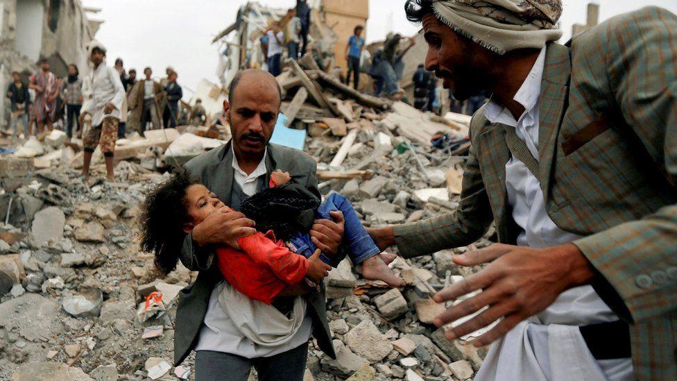 كيف تروي تعز المنقسمة مأساة اليمن؟